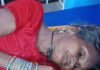सियार ने दो महिलाओं पर किया हमला:इकौना सीएचसी में भर्ती कराया गया, इलाज जारी