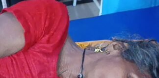सियार ने दो महिलाओं पर किया हमला:इकौना सीएचसी में भर्ती कराया गया, इलाज जारी