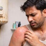 गीजर की अनदेखी से बढ़ सकती हैं स्किन परेशानियां