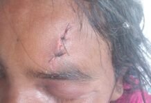 मिहींपुरवा में समूह का पैसा मांगने पर महिला से मारपीट:चार टांके लगे, परिवार थाने पहुंचा; पुलिस पर बदसलूकी का आरोप