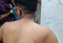 बस्ती में ब्याज के पैसे को लेकर युवक पर हमला:3 लोगों ने लाठी-डंडों से पीटा, गंभीर घायल; केस दर्ज