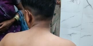 बस्ती में ब्याज के पैसे को लेकर युवक पर हमला:3 लोगों ने लाठी-डंडों से पीटा, गंभीर घायल; केस दर्ज