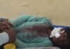 तेंदुए ने 12 साल के बच्चे पर किया हमला:ललतूपुरवा में बच्चा गंभीर घायल, महिला पर हमले की वन विभाग ने नहीं की पुष्टि