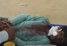 तेंदुए ने 12 साल के बच्चे पर किया हमला:ललतूपुरवा में बच्चा गंभीर घायल, महिला पर हमले की वन विभाग ने नहीं की पुष्टि