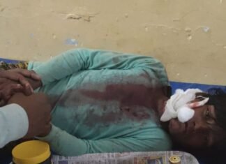 तेंदुए ने 12 साल के बच्चे पर किया हमला:ललतूपुरवा में बच्चा गंभीर घायल, महिला पर हमले की वन विभाग ने नहीं की पुष्टि