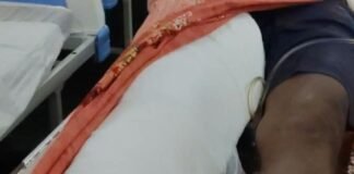 छत पर काम करते समय पैर फिसला:नीचे गिरकर घायल हुआ युवक; जिला अस्पताल में भर्ती