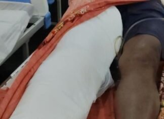 छत पर काम करते समय पैर फिसला:नीचे गिरकर घायल हुआ युवक; जिला अस्पताल में भर्ती