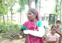 बाइक से बचने के प्रयास में महिला गिरी,:दोबारा इलाज के लिए पैसे नहीं, प्रशासन से आर्थिक मदद की गुहार लगाई