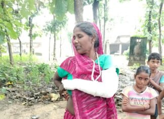 बाइक से बचने के प्रयास में महिला गिरी,:दोबारा इलाज के लिए पैसे नहीं, प्रशासन से आर्थिक मदद की गुहार लगाई