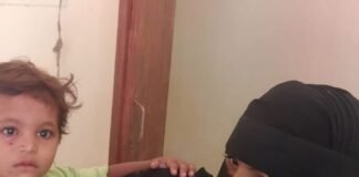 बंदर के हमले में 4 साल का बालक घायल:नई बस्ती में घर के बाहर खेल रहा था, परिजनों ने बचाया; अस्पताल में भर्ती