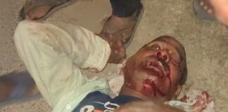 सिसवा अमाहवां बैरियर के पास सड़क हादसा, व्यक्ति घायल:बाइक की चपेट में आने से गंभीर चोटें, अस्पताल में भर्ती
