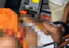 पत्नी की विदाई कर लौट रहे युवक पर जानलेवा हमला:बस्ती में चार नामजद समेत सात पर केस दर्ज, इलाज जारी