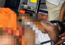 पत्नी की विदाई कर लौट रहे युवक पर जानलेवा हमला:बस्ती में चार नामजद समेत सात पर केस दर्ज, इलाज जारी
