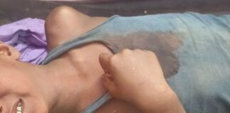 अज्ञात बाइक की ठोकर से बच्चा गंभीर घायल:जमुनहा के प्रतापपुर गांव में हादसा, प्राथमिक उपचार के बाद भिनगा रेफर