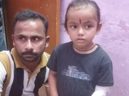 कुत्ते ने 4 साल की बच्ची को काटा:जमुनहा के ग्राम पंचायत सर्रा गांव में खेल रही थी आरोही, सीएचसी में भर्ती