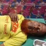 श्रावस्ती में लकड़ी काटते समय बुजुर्ग का हाथ कटा:परिजन निजी वाहन से अस्पताल ले गए, इलाज जारी है श्रावस्ती में लकड़ी काटते समय बुजुर्ग का हाथ कटा:परिजन निजी वाहन से अस्पताल ले गए, इलाज जारी है