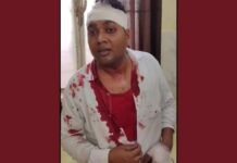 UP: जौनपुर ग्राम विकास अधिकारी पर हमले का आरोप, लोहे की रॉड और लाठी-डंडों से मारपीट की शिकायत