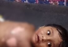मामूली विवाद में मासूम पर फेंका गर्म दूध, बच्चा झुलसा:श्रावस्ती के अहिरन पुरवा लाल बोझी गांव की घटना; सीएचसी इकौना लेकर पहुंचे