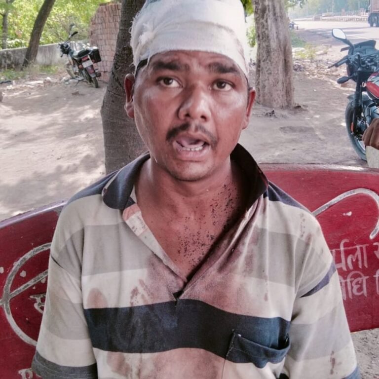 मजदूरी मांगने पहुंचे युवक के सिर पर टॉर्च से वार:बस्ती के विक्रमजोत बाजार में मारपीट का आरोप, पुलिस ने आरोपी को चौकी बुलाया