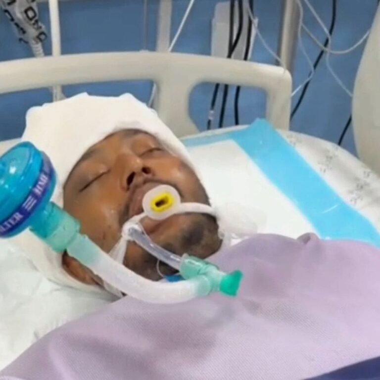 पुणे में पेंटिंग करते समय सातवीं मंजिल से गिरा युवक:श्रावस्ती के गिलौला निवासी गंभीर घायल, सुरक्षा उपकरण न होने से हुआ हादसा