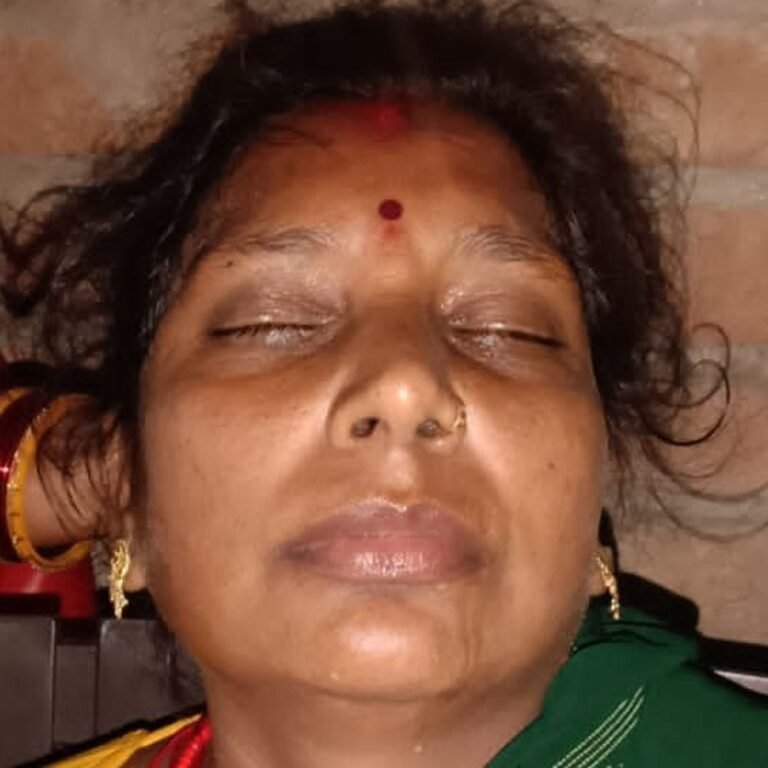 ई-रिक्शा की टक्कर से महिला गंभीर रूप से घायल:कटहरी बाजार में खरीदारी करने जा रही थी, सिर और हाथ में चोटें