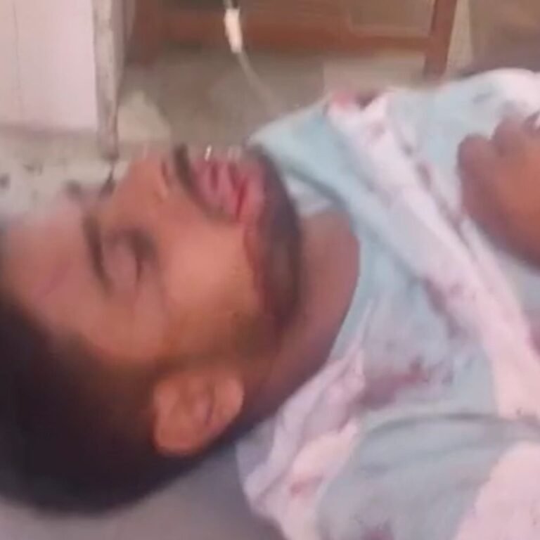 देर रात सड़क हादसा, बाइक सवार दो युवक गंभीर घायल:सिसवा में मारुति से टकराई बाइक, प्राथमिक उपचार के बाद जिला अस्पताल रेफर