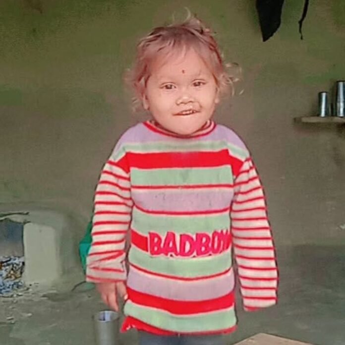 करंट लगने से 3 साल के मासूम की मौत:बेटे को बचाने दौड़ी मां भी झुलसी, अस्पताल में चल रहा इलाज