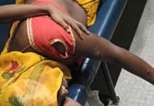 बाइक खड़ी करने के विवाद में मारपीट:सात लोग घायल, चार मेडिकल कॉलेज रेफर, एक पक्ष पर केस दर्ज बाइक खड़ी करने के विवाद में मारपीट:सात लोग घायल, चार मेडिकल कॉलेज रेफर, एक पक्ष पर केस दर्ज