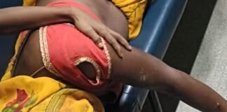 बाइक खड़ी करने के विवाद में मारपीट:सात लोग घायल, चार मेडिकल कॉलेज रेफर, एक पक्ष पर केस दर्ज बाइक खड़ी करने के विवाद में मारपीट:सात लोग घायल, चार मेडिकल कॉलेज रेफर, एक पक्ष पर केस दर्ज