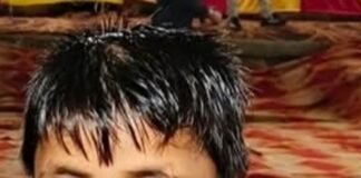 11 साल का बच्चा करंट की चपेट में आया:लालगंज में लापरवाही से हालत गंभीर, ग्रामीणों ने बिजली विभाग पर लगाए आरोप 11 साल का बच्चा करंट की चपेट में आया:लालगंज में लापरवाही से हालत गंभीर, ग्रामीणों ने बिजली विभाग पर लगाए आरोप