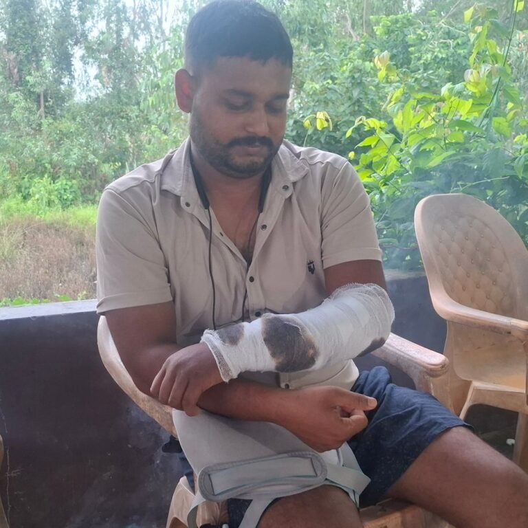 बंदर को बचाते समय बाइक सवार युवक हादसे का शिकार:श्रावस्ती में गंभीर हालत में जिला मेडिकल कॉलेज रेफर