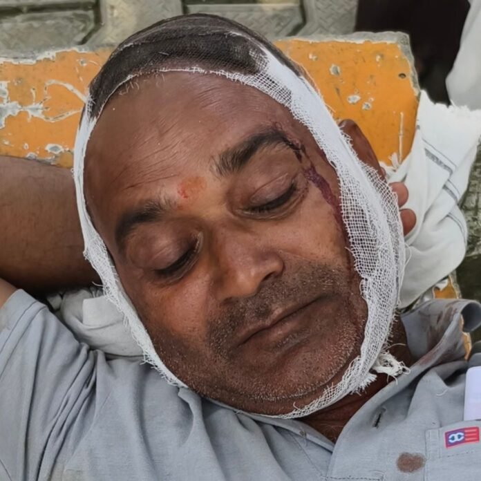 पनियरा में नाली विवाद में दो पाटीदारों में मारपीट:दोनों पक्षों से आठ लोग घायल, पुलिस जांच शुरू
