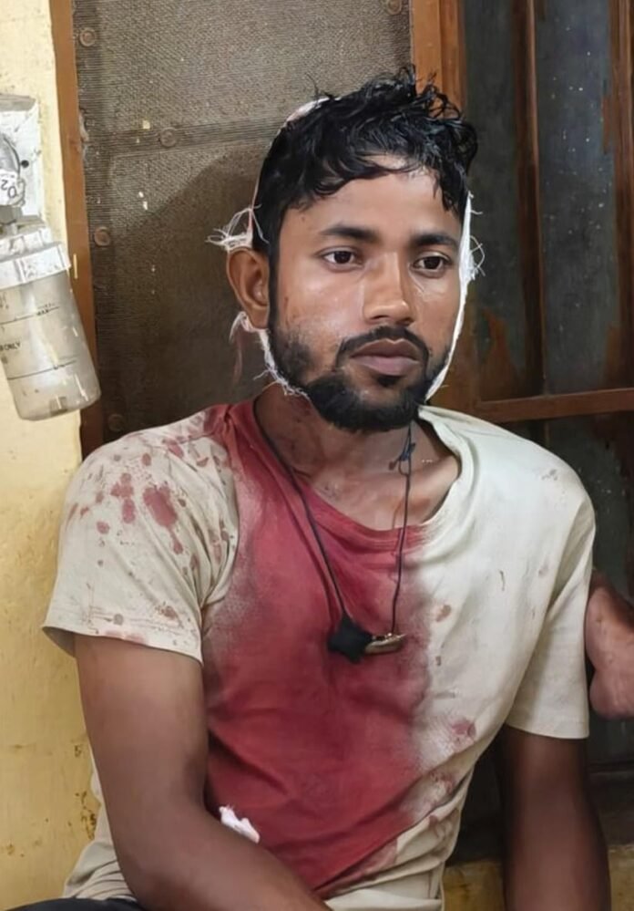 मारपीट में घायल युवक।