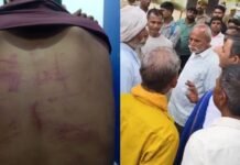 मुरादाबाद:भाजपा विधायक के महल में दो युवकों को करंट लगा पीटने का आरोप, एक की हालत बिगड़ी, परिजनों ने दी तहरीर – Moradabad: Allegations Of Two Youths Being Beaten And Subjected To Electric Shocks At A Bjp Mla Mansion मुरादाबाद:भाजपा विधायक के महल में दो युवकों को करंट लगा पीटने का आरोप, एक की हालत बिगड़ी, परिजनों ने दी तहरीर - Moradabad: Allegations Of Two Youths Being Beaten And Subjected To Electric Shocks At A Bjp Mla Mansion