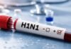 जांजगीर-चांपा में तेजी से फैल रहा H1N1! एक युवक की मौत, जिले में 6 संदिग्ध मरीजों से बढ़ी चिंता